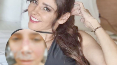 ¡Dorismar desfigurada y mutilada! irreconocible tras cirugía estética