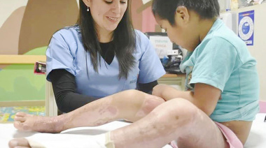 Protección Civil previene quemaduras en invierno